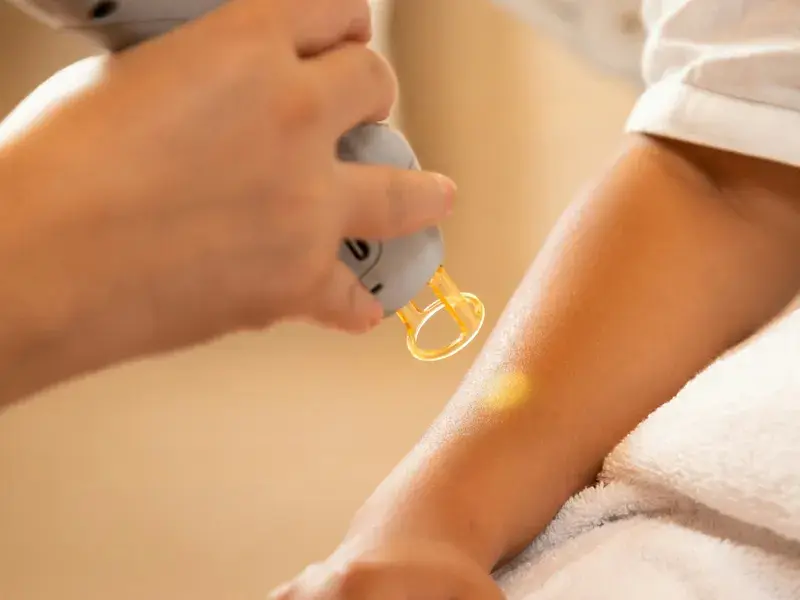 Laser tattoo removal: how many sessions you need