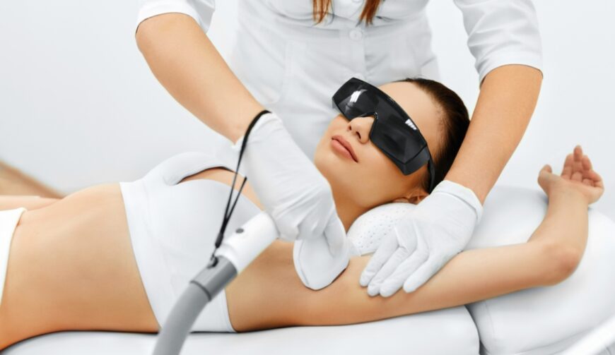 hair removal laser