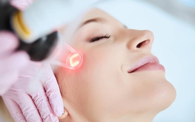 Laser CO2 Fractional Playa del Carmen