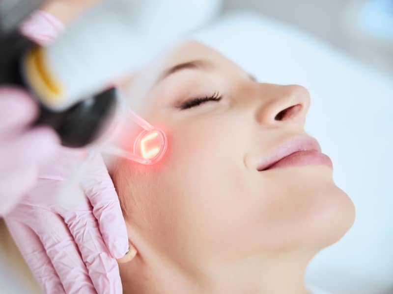 Laser CO2 Fractional Playa del Carmen